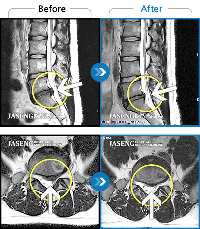 ڻѹ溴 ġ MRI  ġ-㸮      .