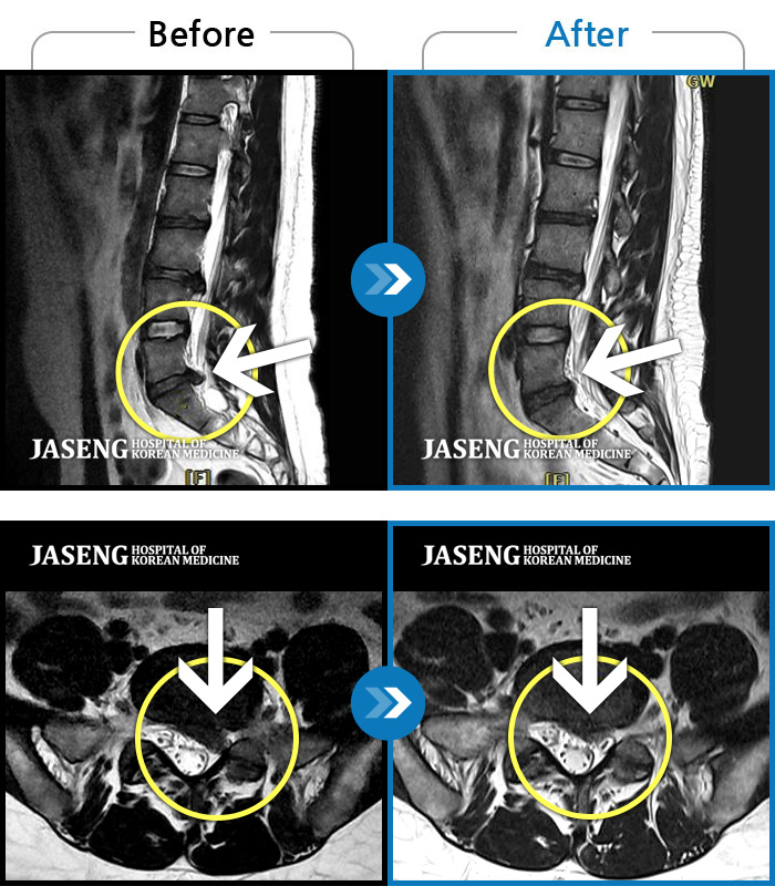 ڻѹ溴 ġ MRI  ġ- 㸮  ٸ ̾  ϼ̽ϴ. 