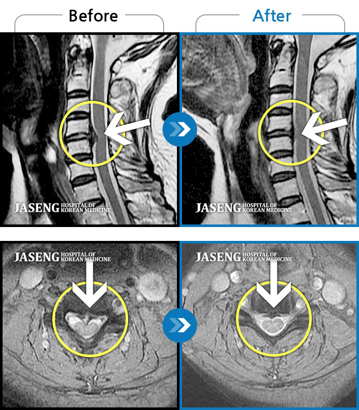 ûڻѹ溴 ġ MRI  ġ-   īӰ .