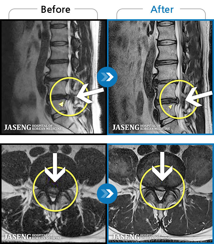 ڻѹ溴 ġ MRI  ġ-㸮  ϰ  ,   ̾   ϼ̽ϴ.