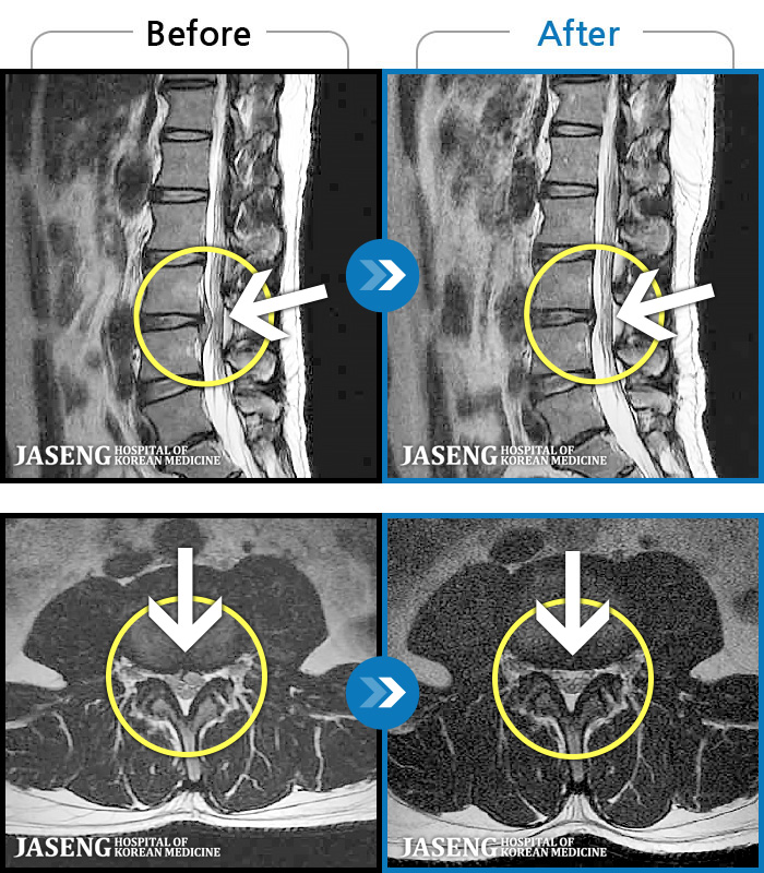 ڻѹ溴 ġ MRI  ġ-ġ  ٸ ,    . 