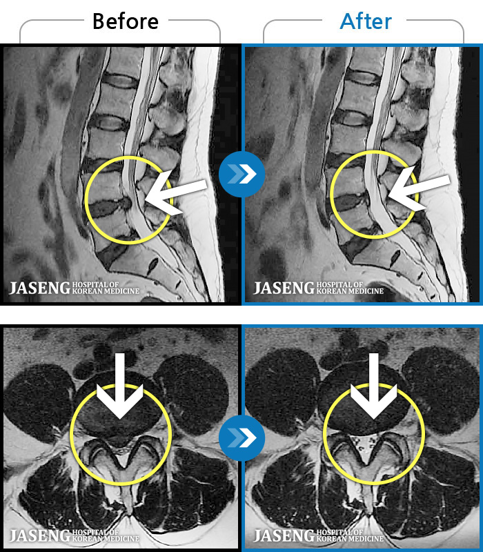 ڻѹ溴 ġ MRI  ġ- 㸮 ġ , ٸ   ϰ . 