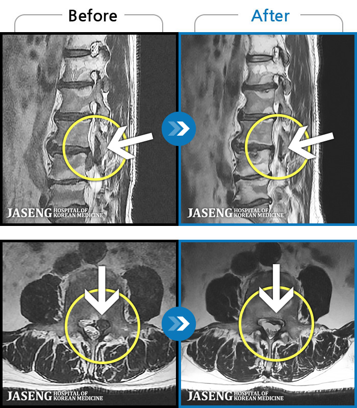 ûڻѹ溴 ġ MRI  ġ-㸮      Ͽ ϻȰ  ¿ϴ.