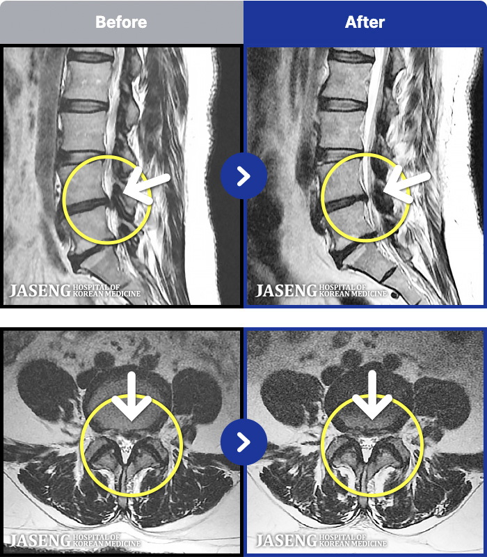 �����ڻ��ѹ溴�� ġ���� MRI�� ���� ġ����-���� �㸮, ���, ���� ���� �������� �ؽ��� ������ ������ ���ϰ� �ϻ��Ȱ�� �Ұ����� ���¿����ϴ�.
