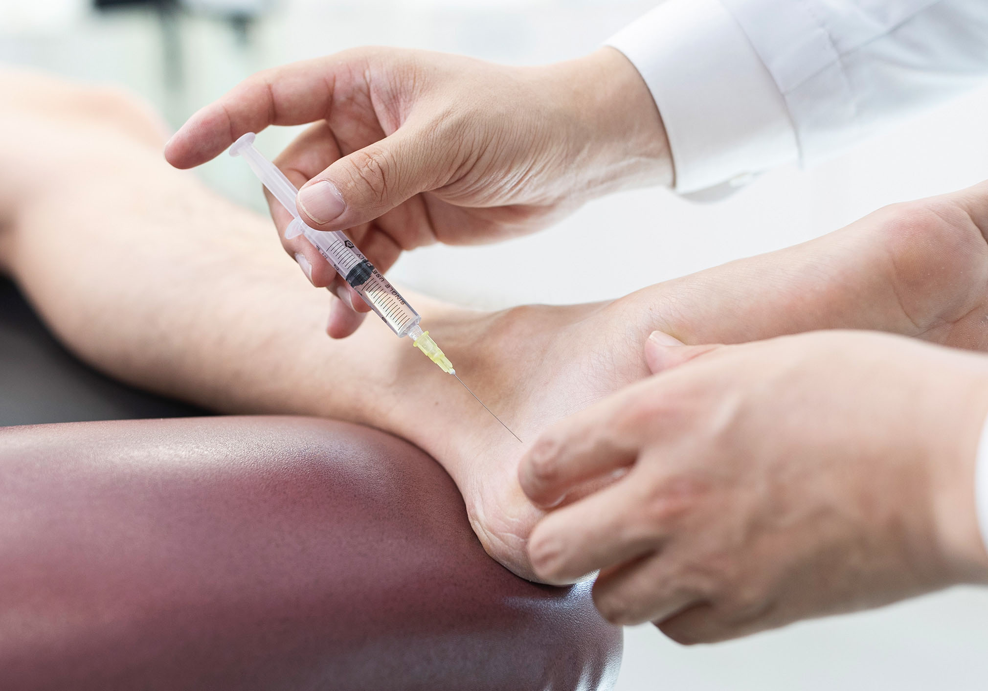 신바로약침 · 봉침