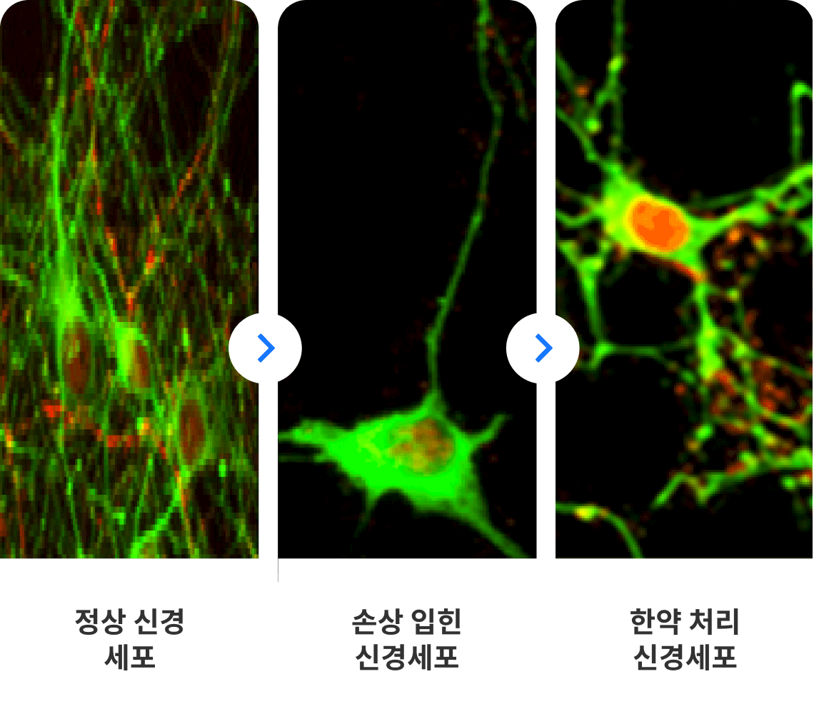 정상 신경세포, 손상 입힌 신경세포, 한약 처리 신경세포 비교